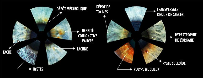 Iridologie e le ments observables